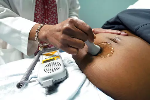 A doctor uses a hand-held Doppler probe on a pregnant woman to measure the heartbeat of the fetus on Dec. 17, 2021, in Jackson, Miss. COVID-19 drove a dramatic increase in the number of women who died from pregnancy or childbirth complications in the U.S. last year, a crisis that has disproportionately claimed Black and Hispanic women as victims, according to a report released Wednesday, Oct. 19, 2022. (AP Photo/Rogelio V. Solis, File)