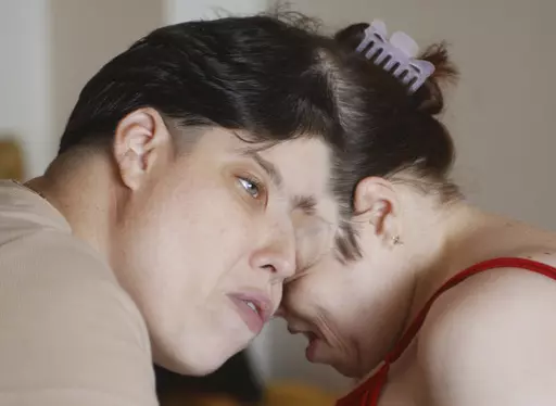 In this July 8, 2003 photo, Lori, left, and George Schappell, conjoined twins, are photographed in their Reading, Pa., apartment. Lori and George Schappell, who pursued separate careers, interests and relationships during lives that defied medical expectations, died April 7, 2024, at the Hospital of the University of Pennsylvania. They were 62. (John A. Secoges/Reading Eagle via AP, File)