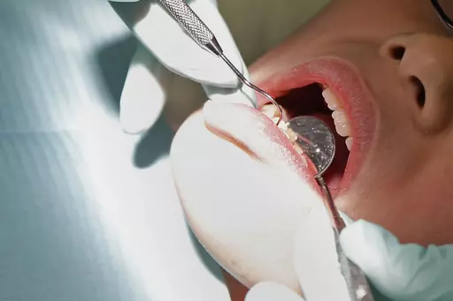 In this Friday, Jan. 22, 2016 photo, a dentist checks the teeth of a patient in Indianapolis. On Friday, April 21, 2023, The Associated Press reported on stories circulating online incorrectly claiming the No. 1 cause of heart attacks is a tooth treated for a root canal. (AP Photo/Michael Conroy, File)