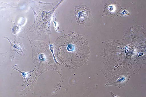 This microscope photo provided by the Mayo Clinic in August 2022 shows senescent myoblast cells. Senescent cells resist apoptosis, or programmed cell death, and characteristically get big and flat, with enlarged nuclei. They release a blend of molecules, some of which can trigger inflammation and harm other cells — and paradoxically also stimulate the growth of malignant cells and fuel cancer, says Mayo Clinic researcher Nathan LeBrasseur. (Dr. Xu Zhang/Mayo Clinic via AP)