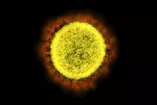 This 2020 electron microscope image made available by the National Institute of Allergy and Infectious Diseases shows a Novel Coronavirus SARS-CoV-2 particle isolated from a patient, in a laboratory in Fort Detrick, Md. The coronavirus mutant widely known as stealth omicron is now causing more than a third of new omicron cases around the world. But scientists still don’t know how it could affect the future of the pandemic. (NIAID/NIH via AP, File)
