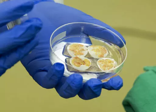 This photo provided by Duke Health shows thymus tissue for transplant to a pediatric heart patient on Aug. 16, 2021 at Duke University Hospital in Durham, N.C. Duke University doctors say the baby is thriving after a first-of-its-kind heart transplant -- one that came with a bonus technique to try to help prevent rejection of the new organ. The thymus plays a critical role in building the immune system. (Shawn Rocco/Duke Health via AP)