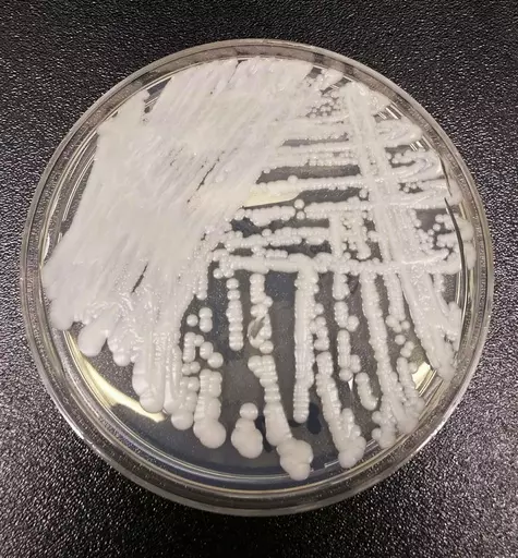 This undated photo made available by the Centers for Disease Control and Prevention shows a strain of Candida auris cultured in a petri dish at a CDC laboratory. In a CDC paper published by the Annals of Internal Medicine on Monday, March 20, 2023, U.S. cases of the dangerous fungus tripled over just three years, and more than half of states have now reported it. (Shawn Lockhart/Centers for Disease Control and Prevention via AP, File)